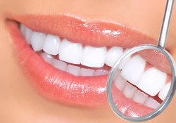Carillas dentales. Mejora tu sonrisa en una cita, sin anestesia y sin dolor