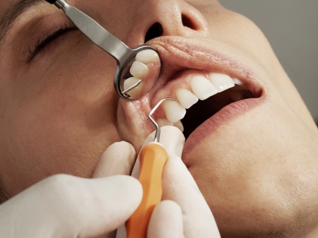 Diferències entre un dentista de la seguretat social i un dentista privat'
