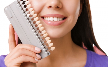 Carillas Dentales de Composite: la solución versátil para la sonrisa que deseas'