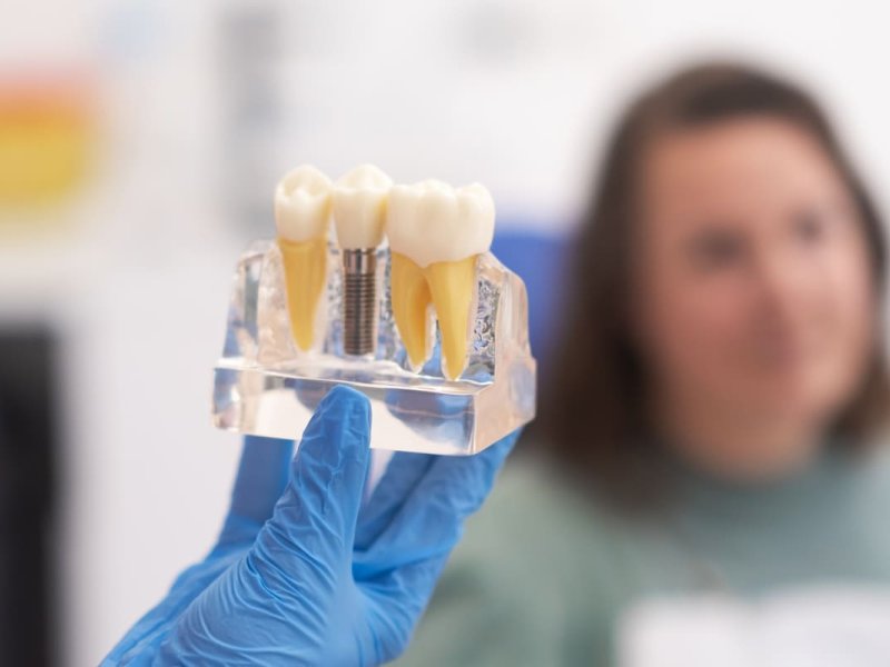 És possible posar-se un implant dental amb poc òs?