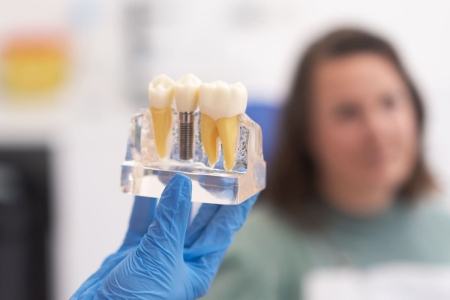 És possible posar-se un implant dental amb poc òs?'